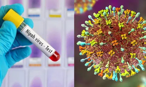 Bộ Y tế hoả tốc yêu cầu cơ sở khám chữa bệnh chủ động phòng chống bệnh do virus Nipah