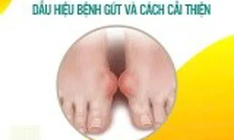 Dấu hiệu bệnh gút và cách cải thiện