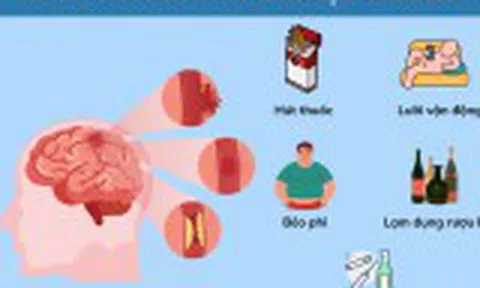 Nguyên nhân tai biến mạch máu não: 6 yếu tố nguy cơ nhiều người đang bỏ qua