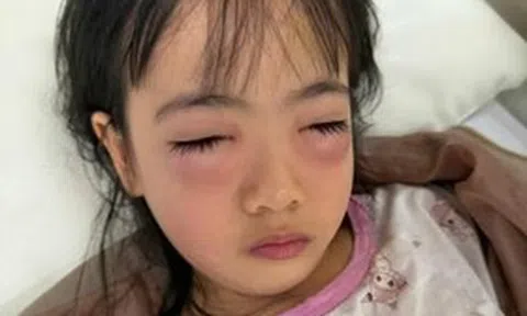 Chơi bong bóng xà phòng, bé 5 tuổi nguy kịch phải cấp cứu, sự thật khiến mẹ "sốc nặng"