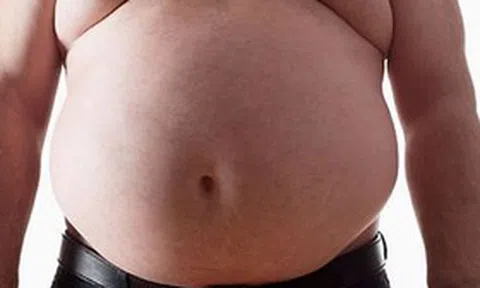 Người đàn ông bụng phình to như "mang thai", bác sĩ lấy ra thứ "đáng sợ" nặng 20kg
