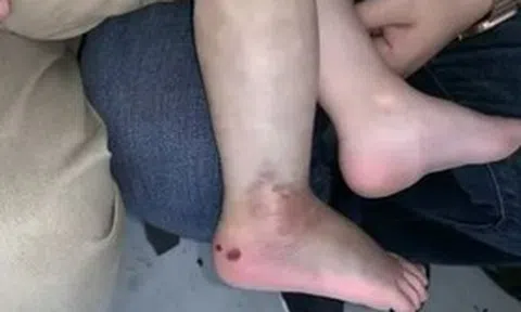 Nghe cháu trai 3 tuổi khóc thét, ông nội chạy ra thì chứng kiến cảnh "đáng sợ"