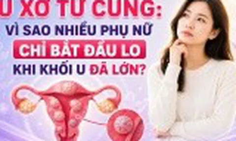 U xơ tử cung: Vì sao nhiều phụ nữ chỉ bắt đầu lo khi khối u đã lớn?