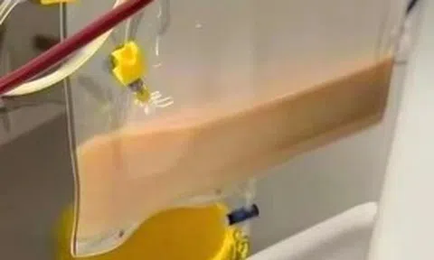 Người phụ nữ 39 tuổi "máu trắng đục như sữa" vì uống thứ nước quen thuộc nhiều người mê