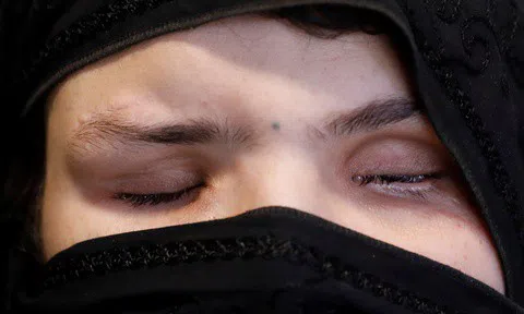 Cô gái Afghanistan bị đâm mù mắt vì kiếm được việc làm